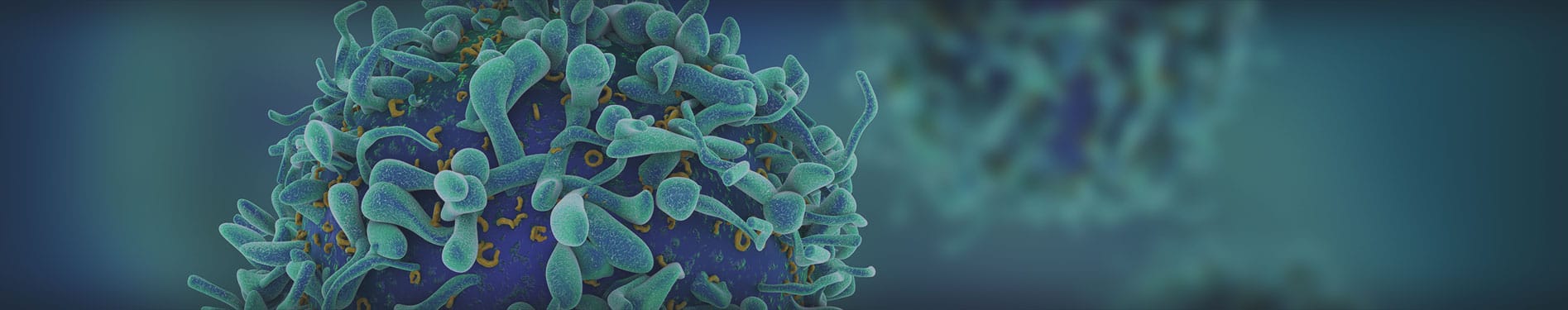 Medical Malpractice in Cancer Diagnosis